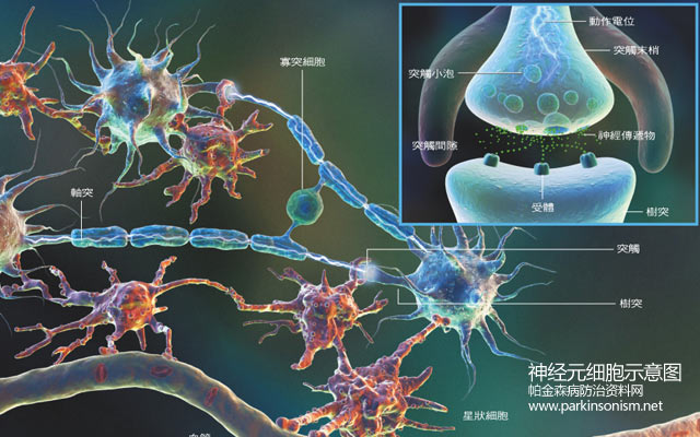 配图: 神经元研究为大脑细胞植入治疗帕金森病提供更好的空间